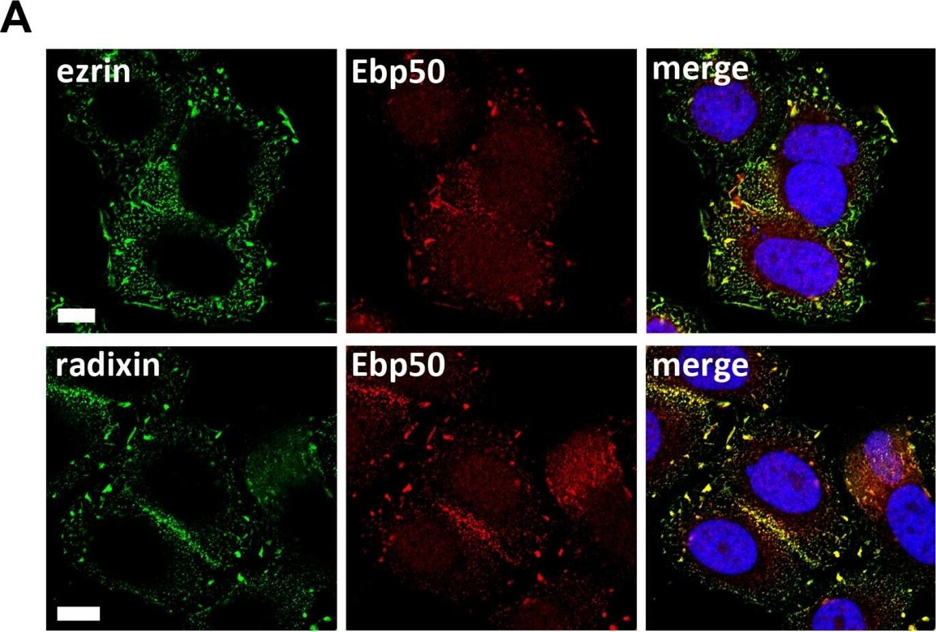 Radixin Antibody (1E12)
