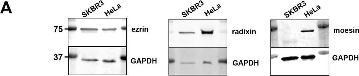Radixin Antibody (1E12)