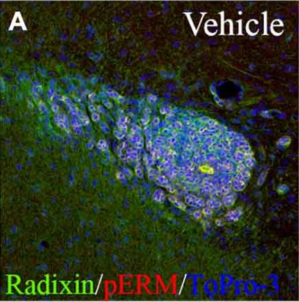 Radixin Antibody (1D9)
