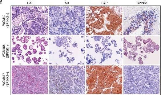 SPINK1 Antibody (4D4)