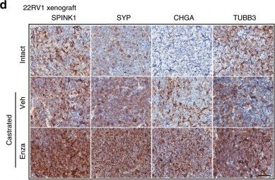 SPINK1 Antibody (4D4)