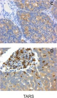 TARS Antibody (1A9)