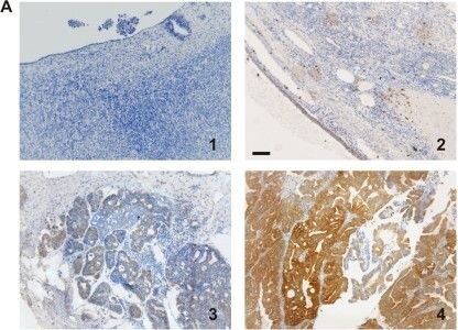 TARS Antibody (1A9)