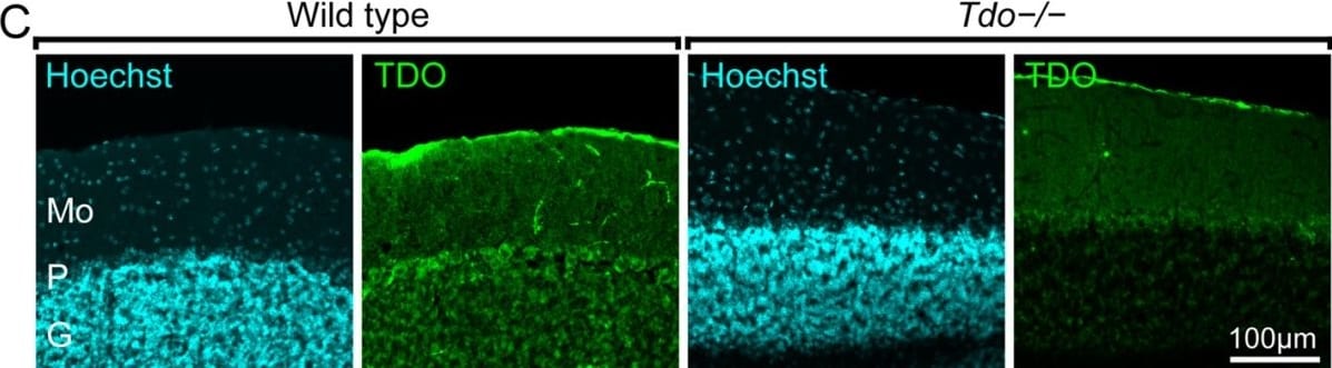 TDO2 Antibody