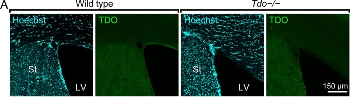TDO2 Antibody