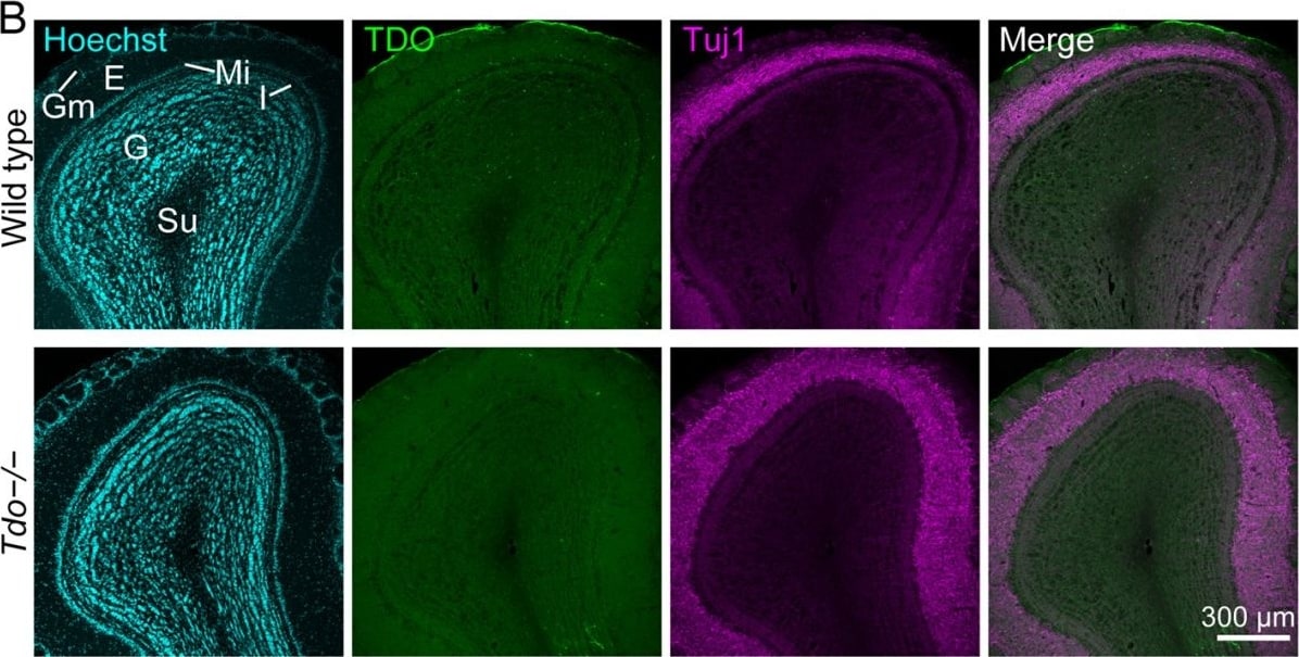 TDO2 Antibody