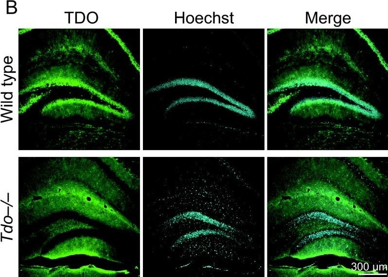 TDO2 Antibody