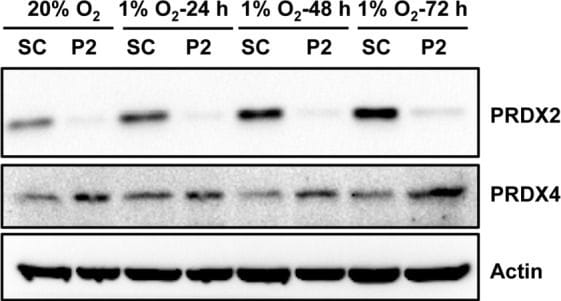 Peroxiredoxin 2 Antibody (4E10-2D2)