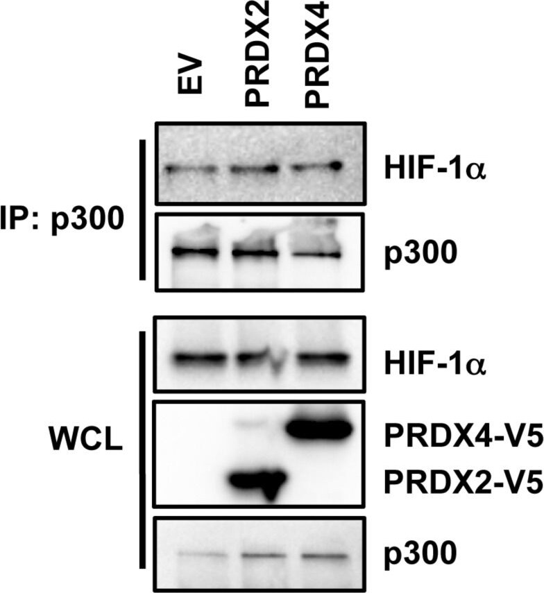 Peroxiredoxin 2 Antibody (4E10-2D2)