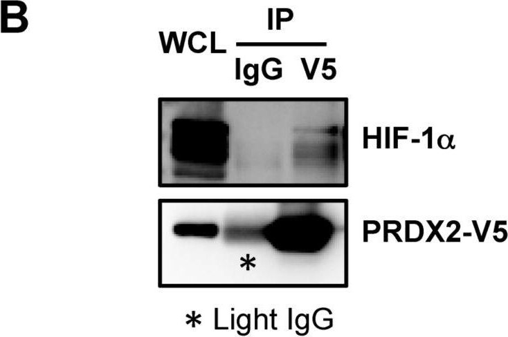 Peroxiredoxin 2 Antibody (4E10-2D2)