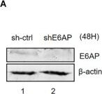 E6AP/UBE3A Antibody (2F6)
