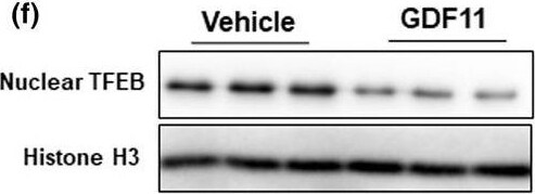 TFEB Antibody (S1)