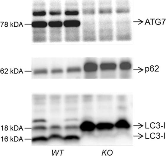 p62/SQSTM1 Antibody (2C11)