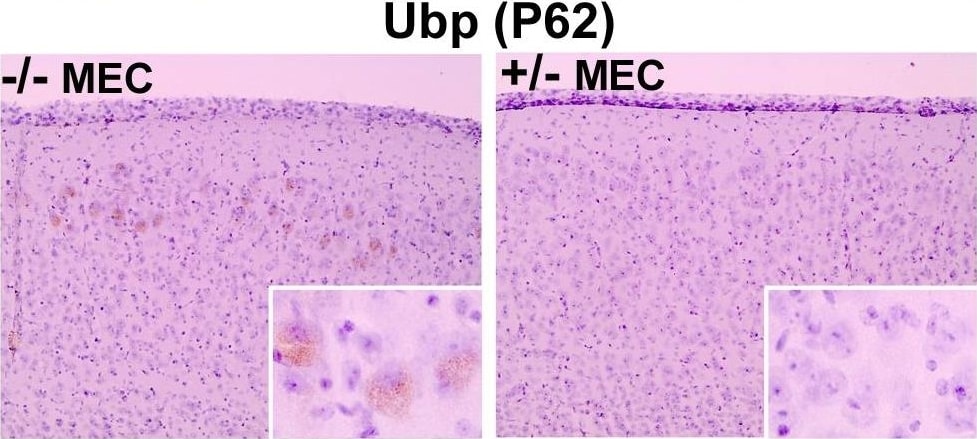 p62/SQSTM1 Antibody (2C11)