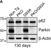 p62/SQSTM1 Antibody (2C11)