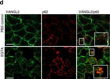 p62/SQSTM1 Antibody (2C11)