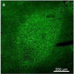 TOMM20 Antibody (4F3)