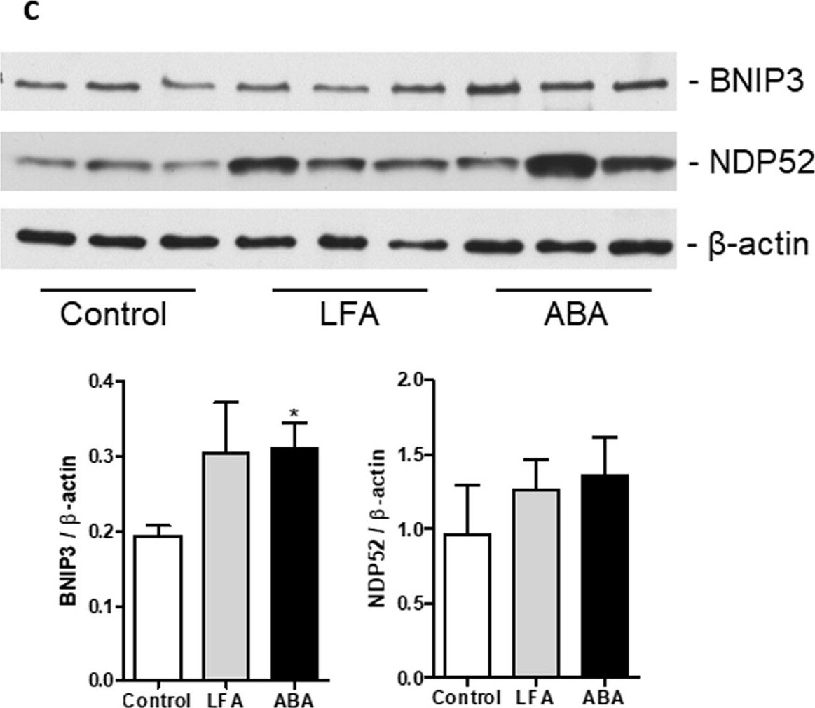 NDP52 Antibody