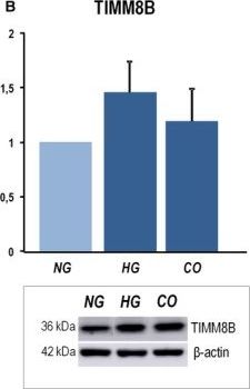 TIMM8B Antibody (8E5)