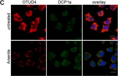 Dcp1a Antibody (3G4)