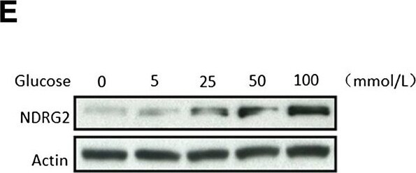 NDRG2 Antibody (6A5)