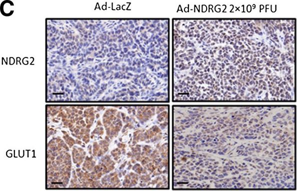 NDRG2 Antibody (6A5)