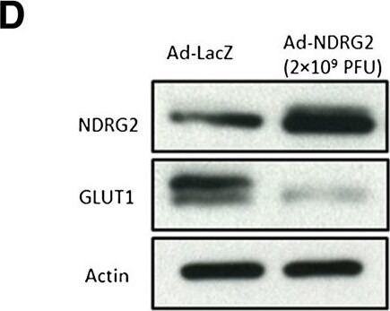 NDRG2 Antibody (6A5)