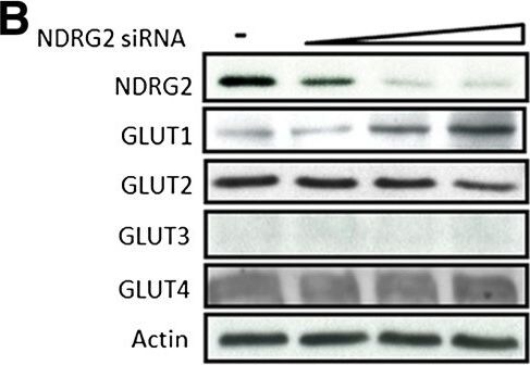 NDRG2 Antibody (6A5)
