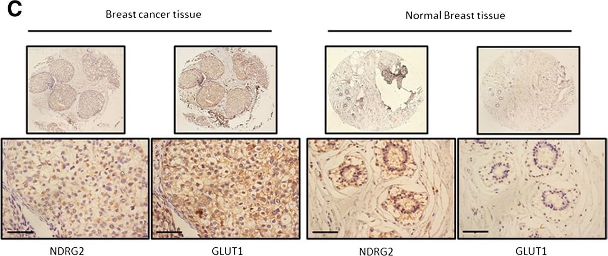 NDRG2 Antibody (6A5)