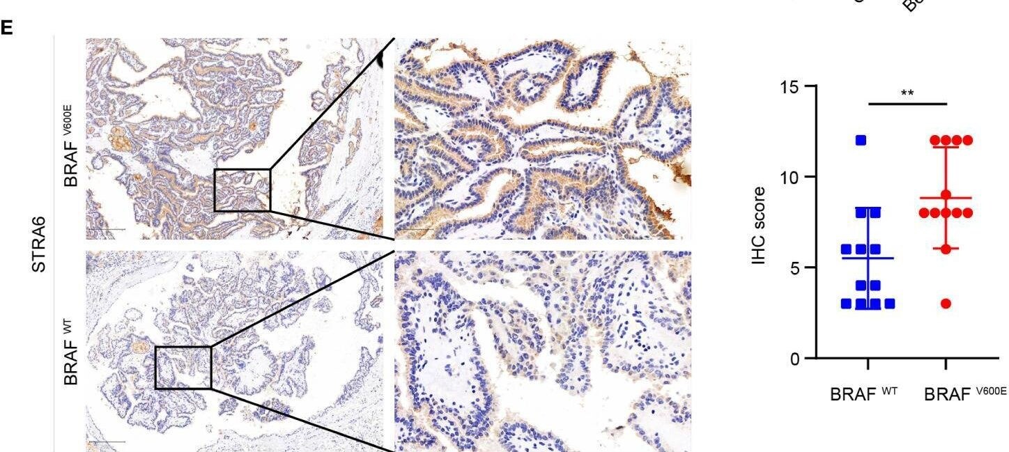 STRA6 Antibody - Azide and BSA Free
