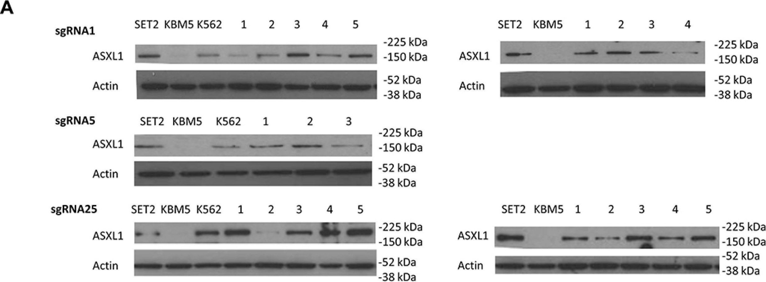 ASXL1 Antibody (6E2)