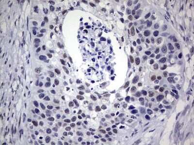 Immunohistochemistry: hHR23b Antibody (OTI7G10) [NBP2-45514]