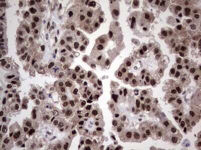 Immunohistochemistry: hHR23b Antibody (OTI7G10) [NBP2-45514]