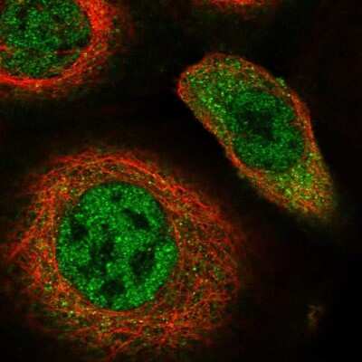 Immunocytochemistry/ Immunofluorescence: hHR23b Antibody [NBP1-89699]