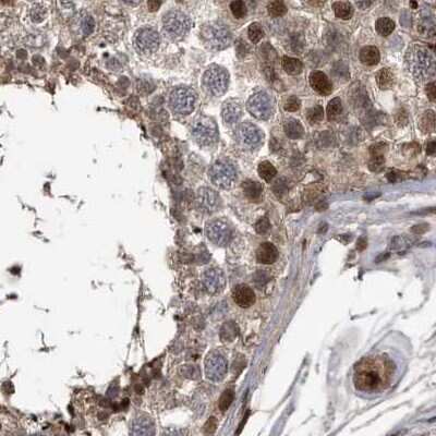 Immunohistochemistry-Paraffin: hHR23b Antibody [NBP1-89698]