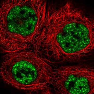 Immunocytochemistry/ Immunofluorescence: hHpr1-p84-Thoc1 Antibody [NBP1-89669]