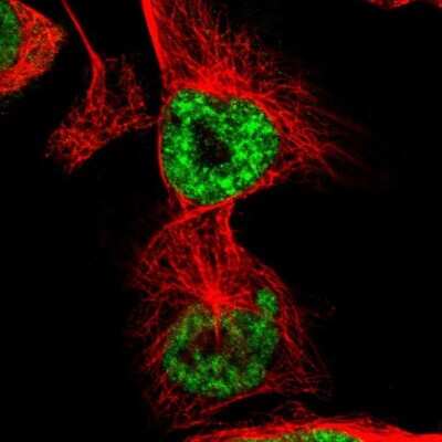 Immunocytochemistry/ Immunofluorescence: hHpr1-p84-Thoc1 Antibody [NBP1-89670]