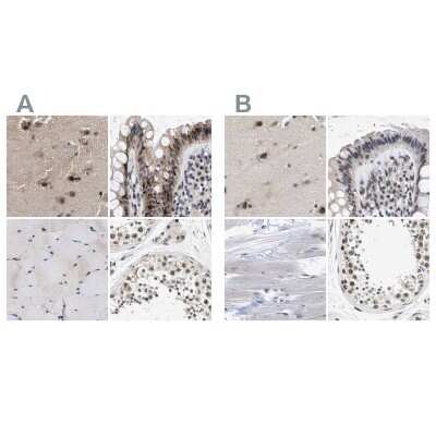 Immunohistochemistry-Paraffin: hHpr1-p84-Thoc1 Antibody [NBP1-89669]