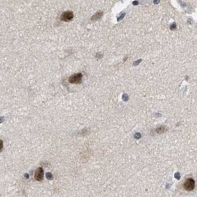 Immunohistochemistry-Paraffin: hHpr1-p84-Thoc1 Antibody [NBP1-89670]