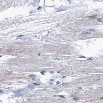 Immunohistochemistry-Paraffin: hHpr1-p84-Thoc1 Antibody [NBP1-89670]
