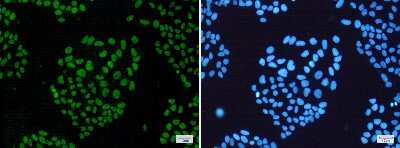 Immunocytochemistry/ Immunofluorescence: hHpr1-p84-Thoc1 Antibody (S05-1A8) [NBP3-14940]