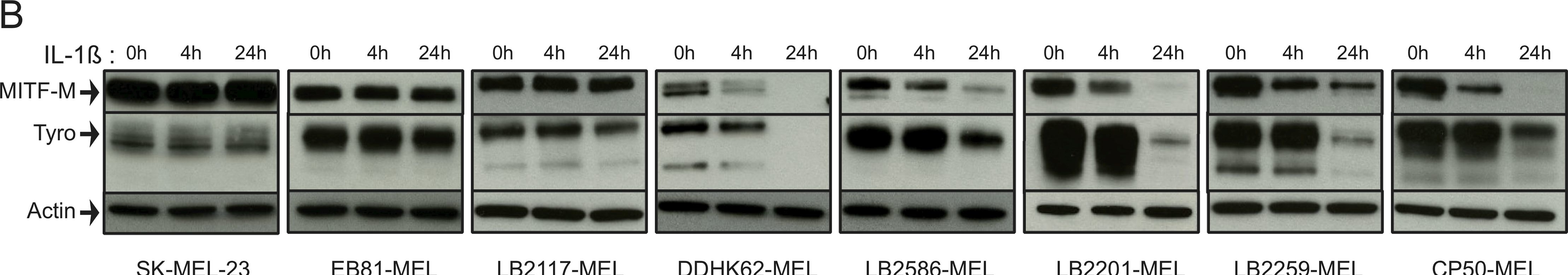 Detection of Human IgG by Western Blot
