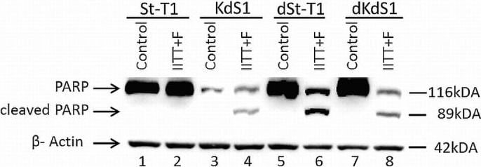 Detection of Human IgG by Western Blot