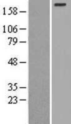 Western Blot: Myosin Heavy Chain 3 Overexpression Lysate [NBL1-13422]