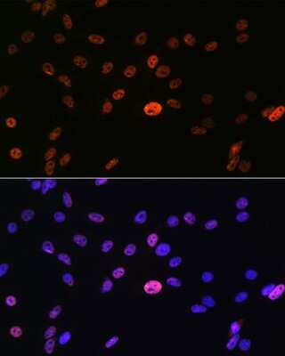 Immunocytochemistry/ Immunofluorescence: hnRNP A1 Antibody (10N0F4) [NBP3-15405]