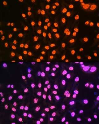 Immunocytochemistry/ Immunofluorescence: hnRNP A1 Antibody (10N0F4) [NBP3-15405]