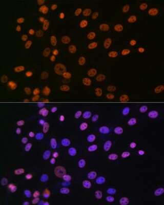 Immunocytochemistry/ Immunofluorescence: hnRNP A1 Antibody (10N0F4) [NBP3-15405]