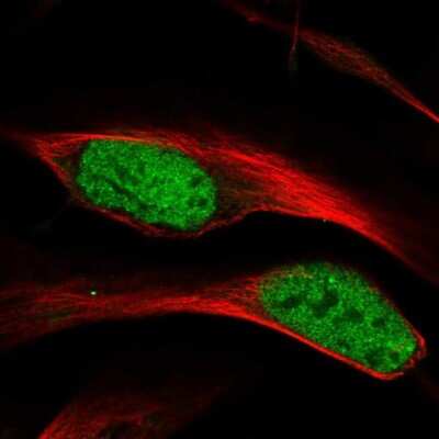 Immunocytochemistry/ Immunofluorescence: hnRNP A1 Antibody [NBP2-58898]