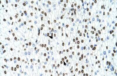 Immunohistochemistry-Paraffin: hnRNP A1 Antibody [NBP1-57121]