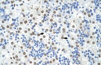 Immunohistochemistry-Paraffin: hnRNP A1 Antibody [NBP1-57121]